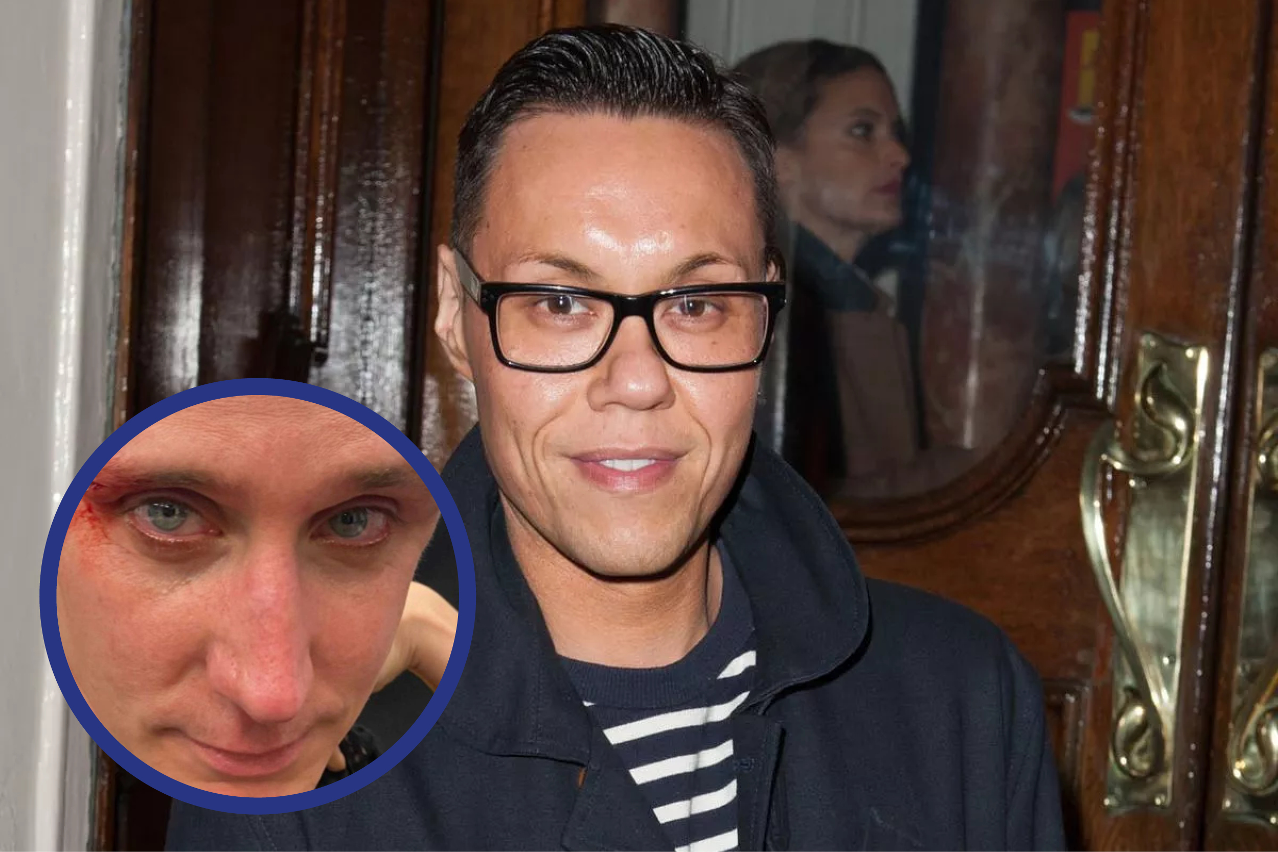 Gok Wan shares graphic images following a homophobic attack on his assistant, who he considers ‘one of our family’